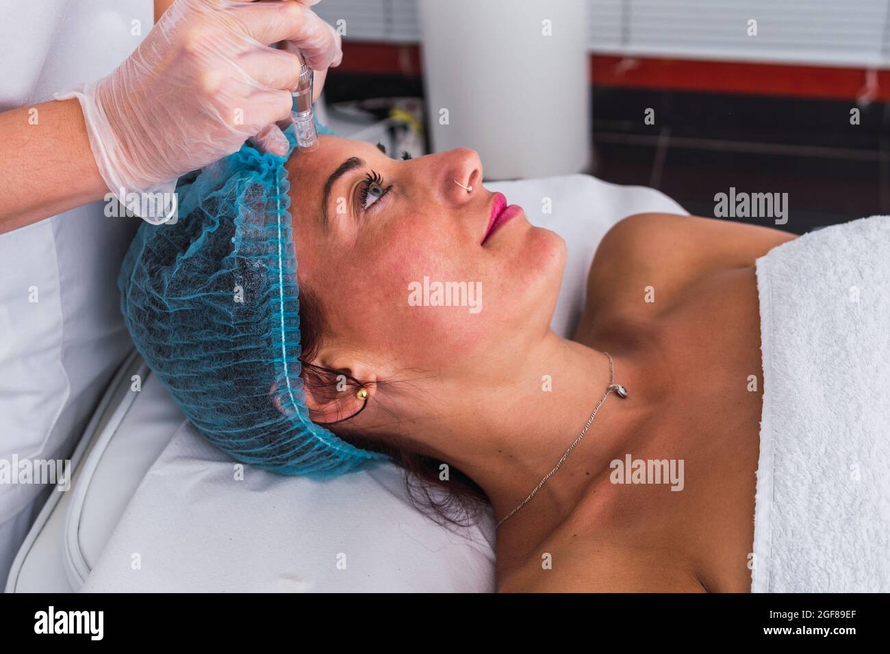 Cosmetologist making mesotherapy treatment with dermapen on face of adult woman Stock Photo