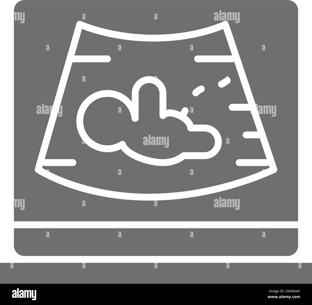 Cervix ultrasound Black and White Stock Photos & Images - Alamy