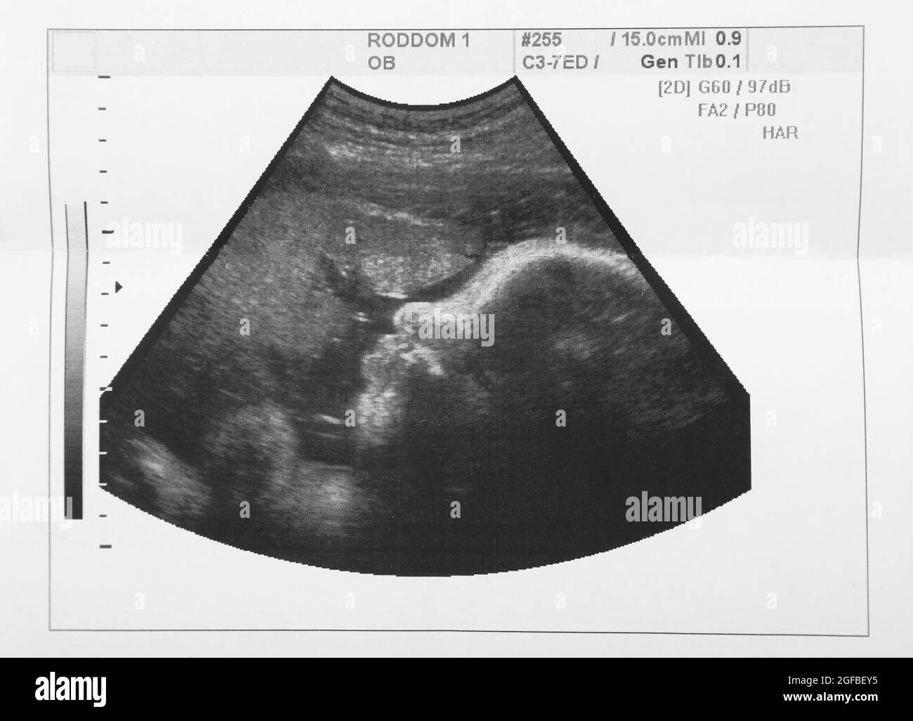 Ultrasound on white background Stock Photo - Alamy