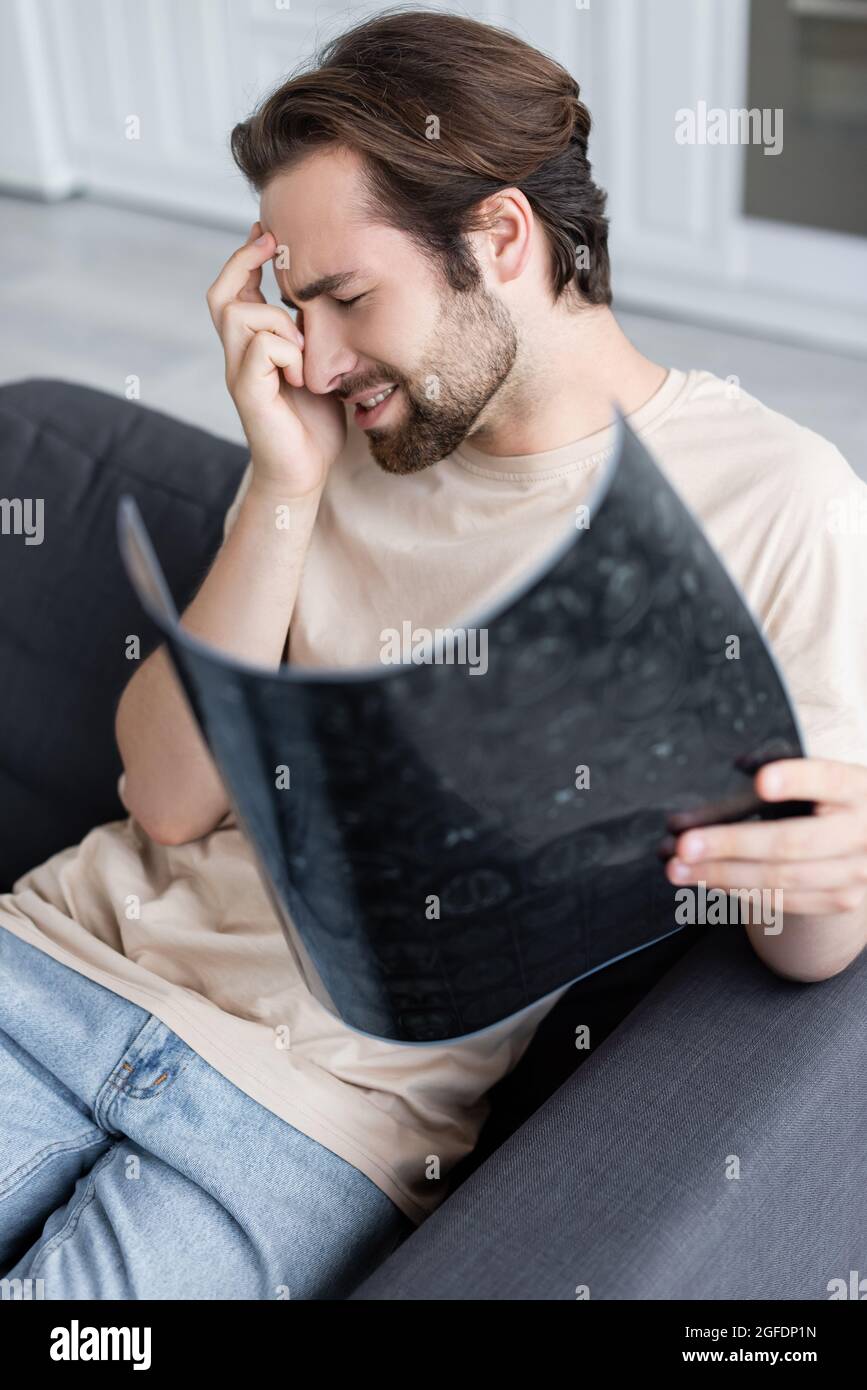 Side view of man suffering from headache while holding mri scan Stock Photo