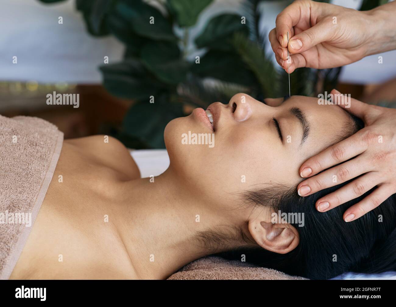 Acupuncture treatment for migraines and headaches. Close-up of reflexologist hand with acupuncture needle near asian woman's forehead Stock Photo