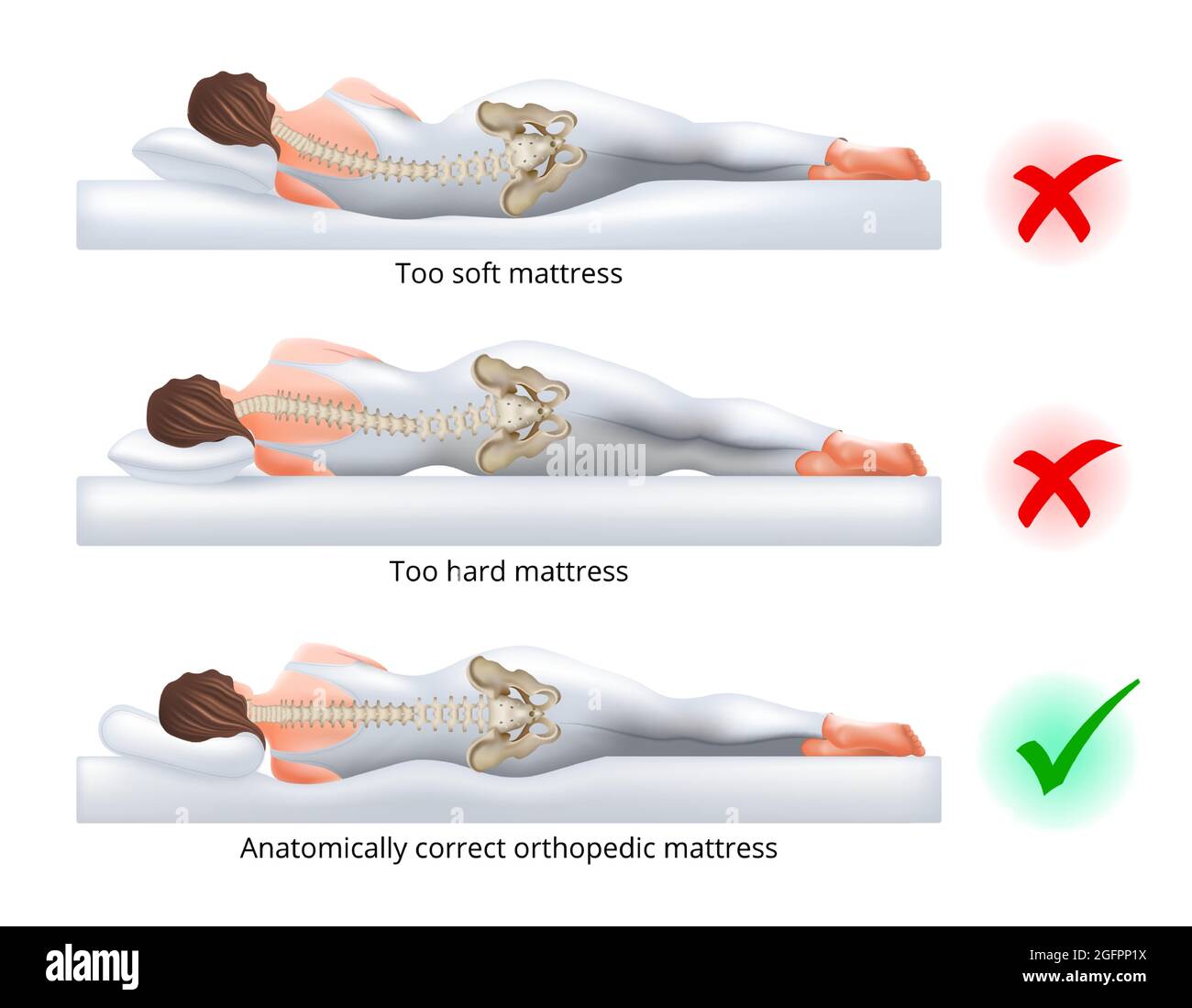 Choosing an orthopedic mattress for sleeping Correct and incorrect