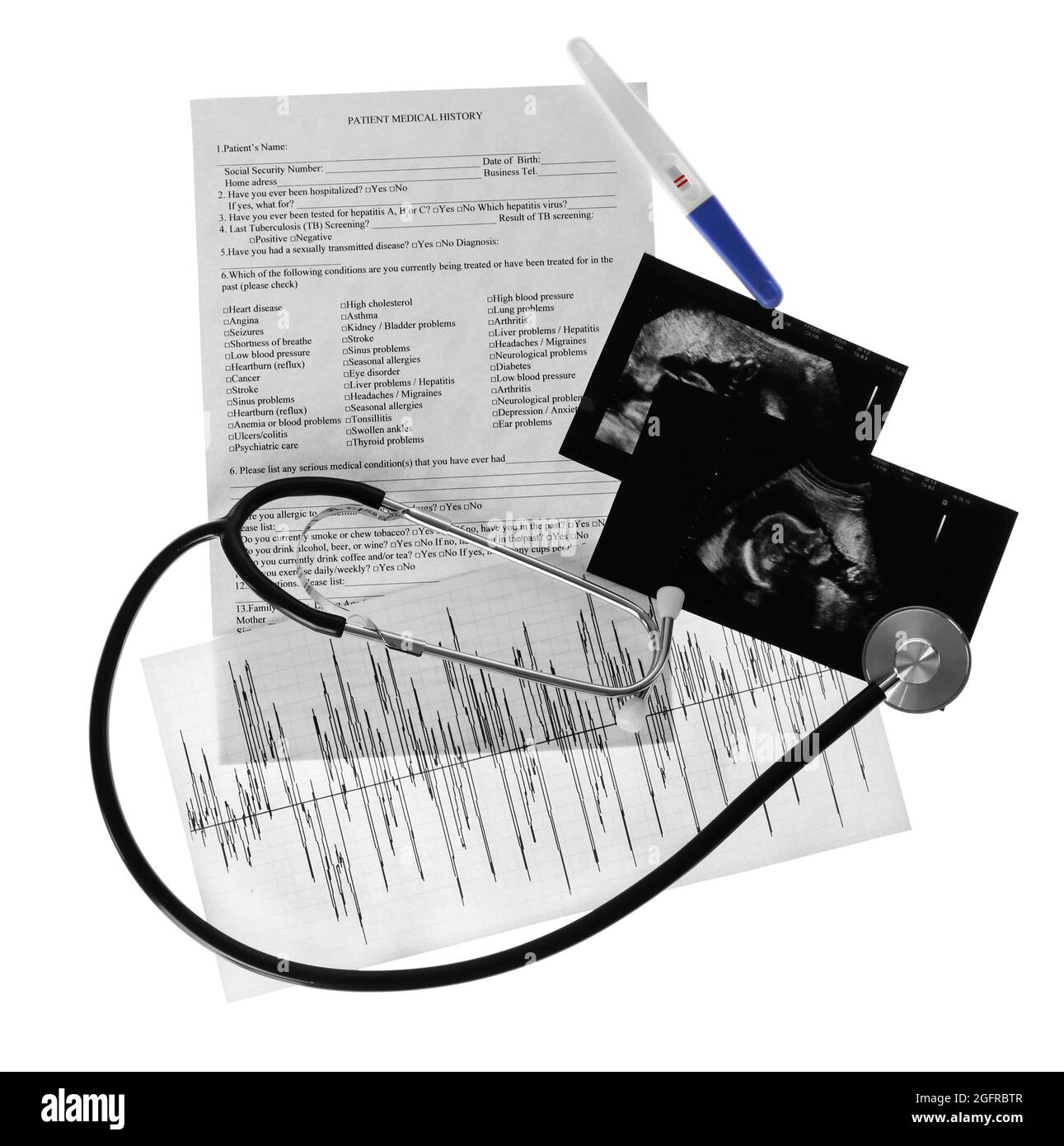 Ultrasound scan of baby and stethoscope on white background Stock Photo