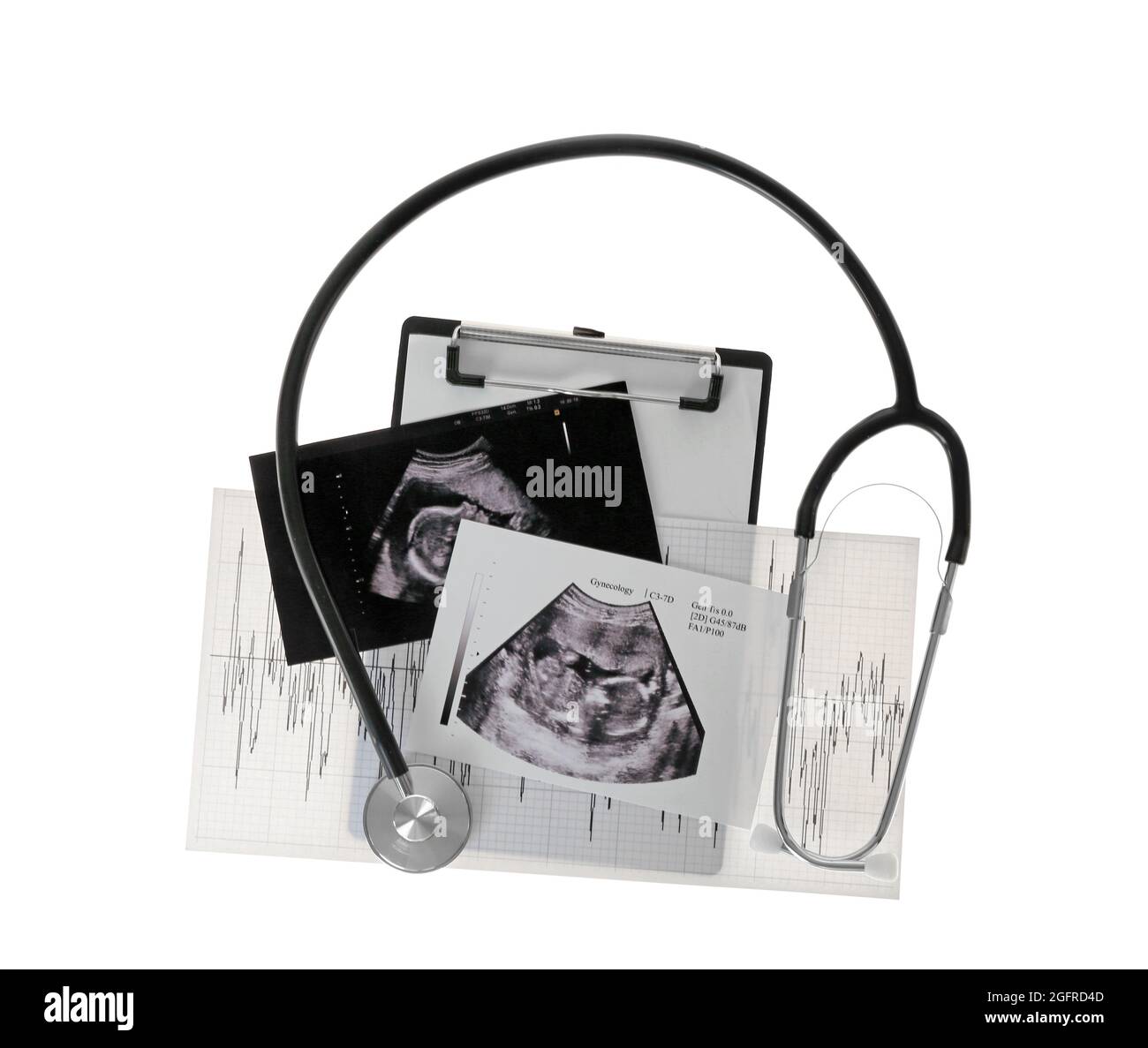 Ultrasound scan of baby and stethoscope on white background Stock Photo