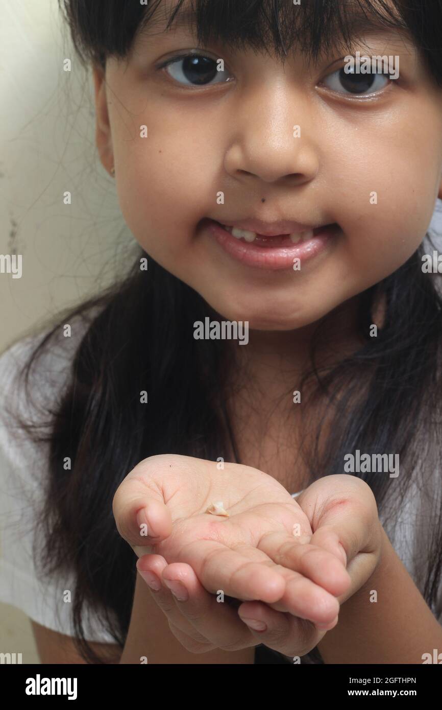 Photo Studio Indoor, Girl Showing her loose teeth Stock Photo
