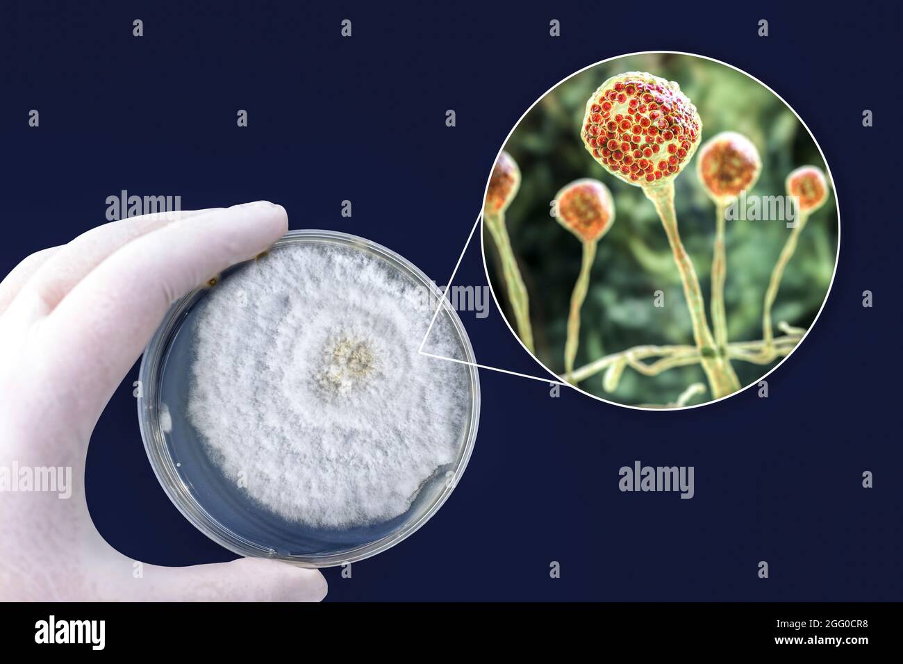 Composite image of mucor mould, also known as black fungus, and pin mould. Mucor sp. fungi are found in soil and decaying organic matter and are common indoor moulds. It can cause the rare but serious disease mucormycosis (zygomycosis) in patients that are immunocompromised or undergoing steroid therapy. The fungus can infect the lungs, sinuses, brain, gastrointestinal system, or the skin. In 2021 outbreaks of mucormycosis were seen in diabetic patients with Covid-19. Treatment is with antifungal drugs, although surgery is often needed to cut away the infected tissue. Stock Photo