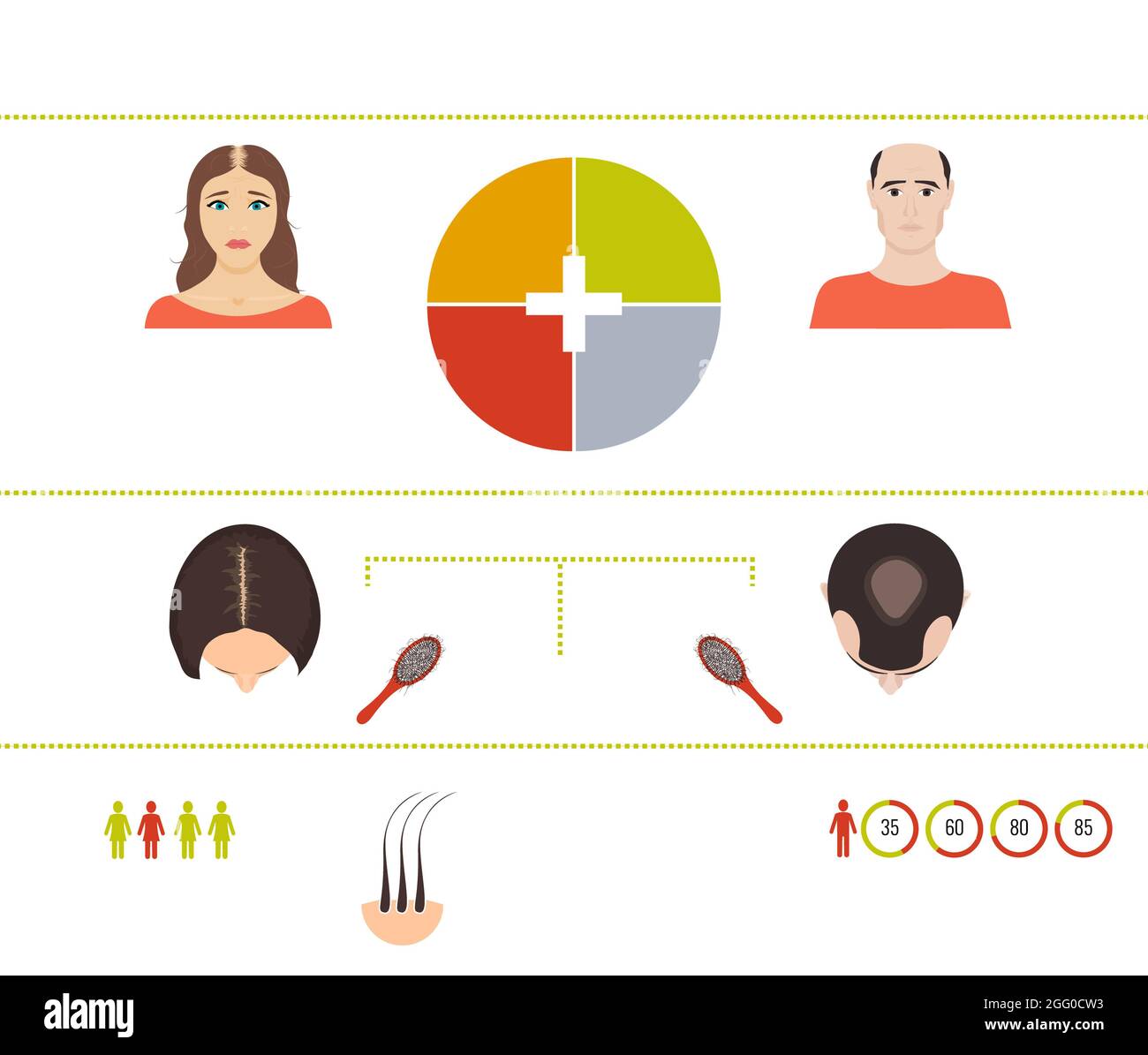 Hair loss symptoms in men and women, illustration. Stock Photo