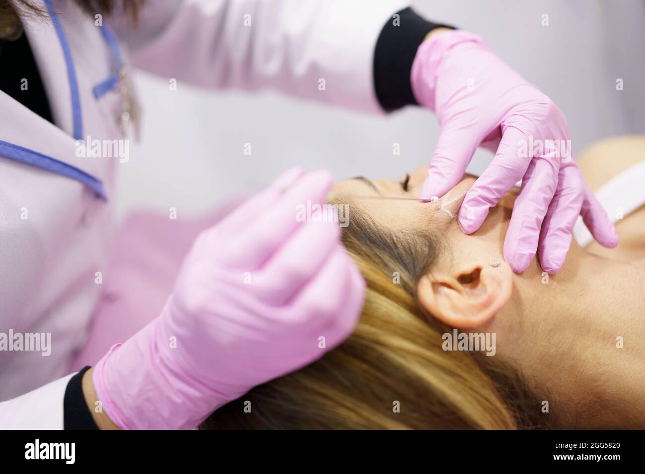Doctor injecting PDO suture treatment threads into the face of a woman. Stock Photo