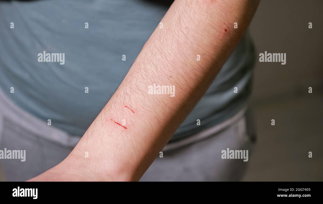 Woman's hand scratched by a cat Stock Photo Alamy