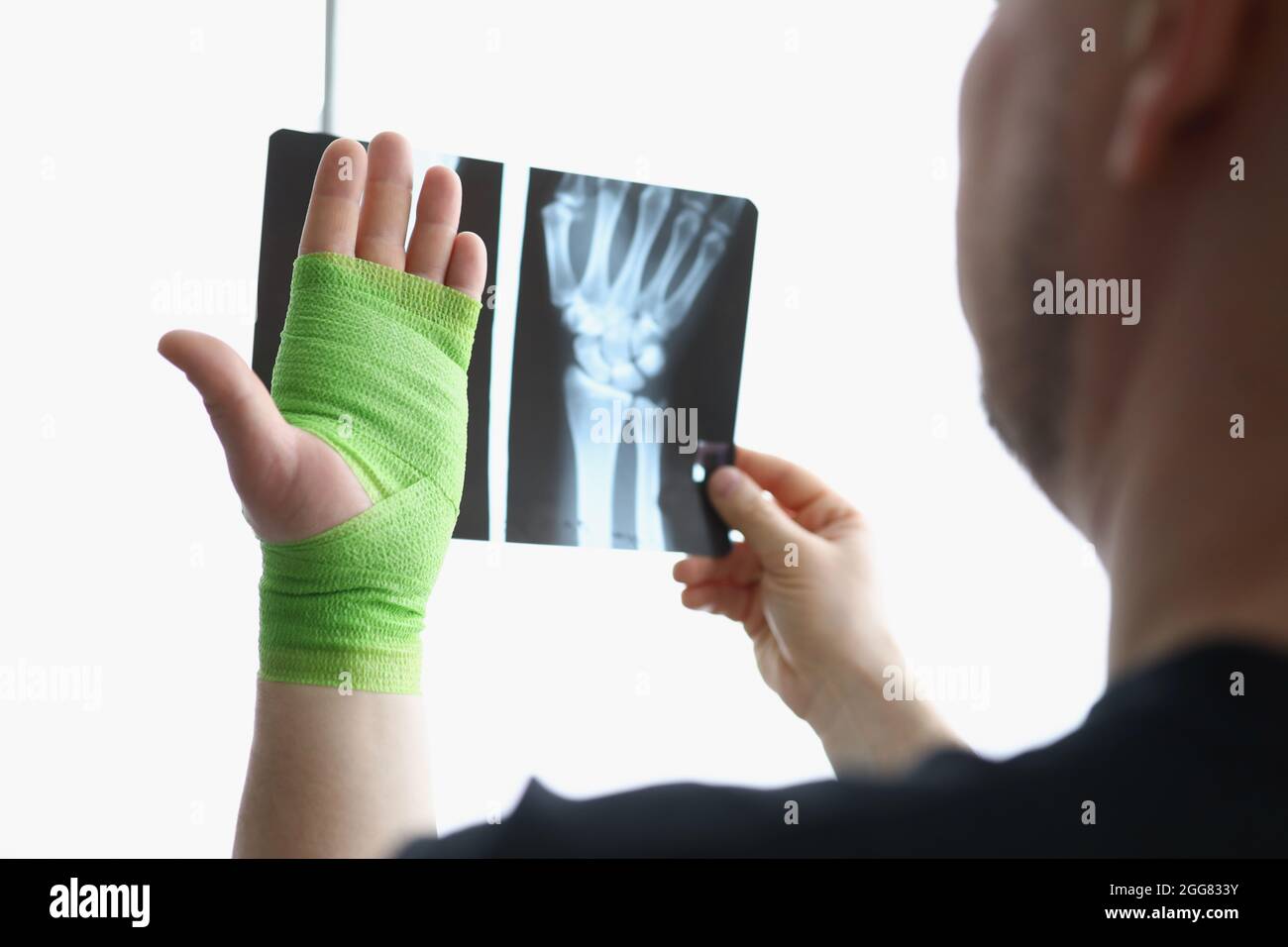 A man looks at an x-ray and a hand in a bandage Stock Photo