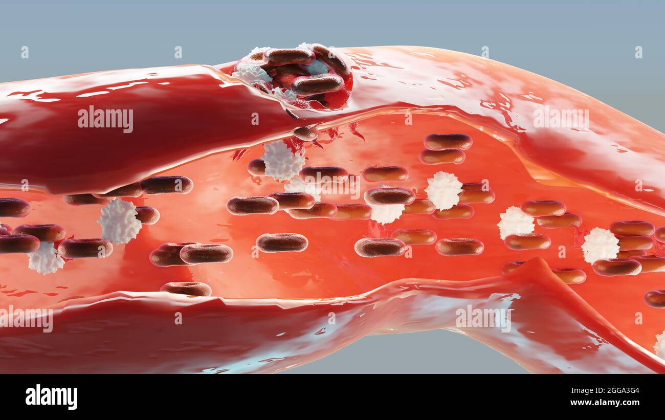 Hemostasis. Red blood cells and platelets in the blood vessel. Basic ...