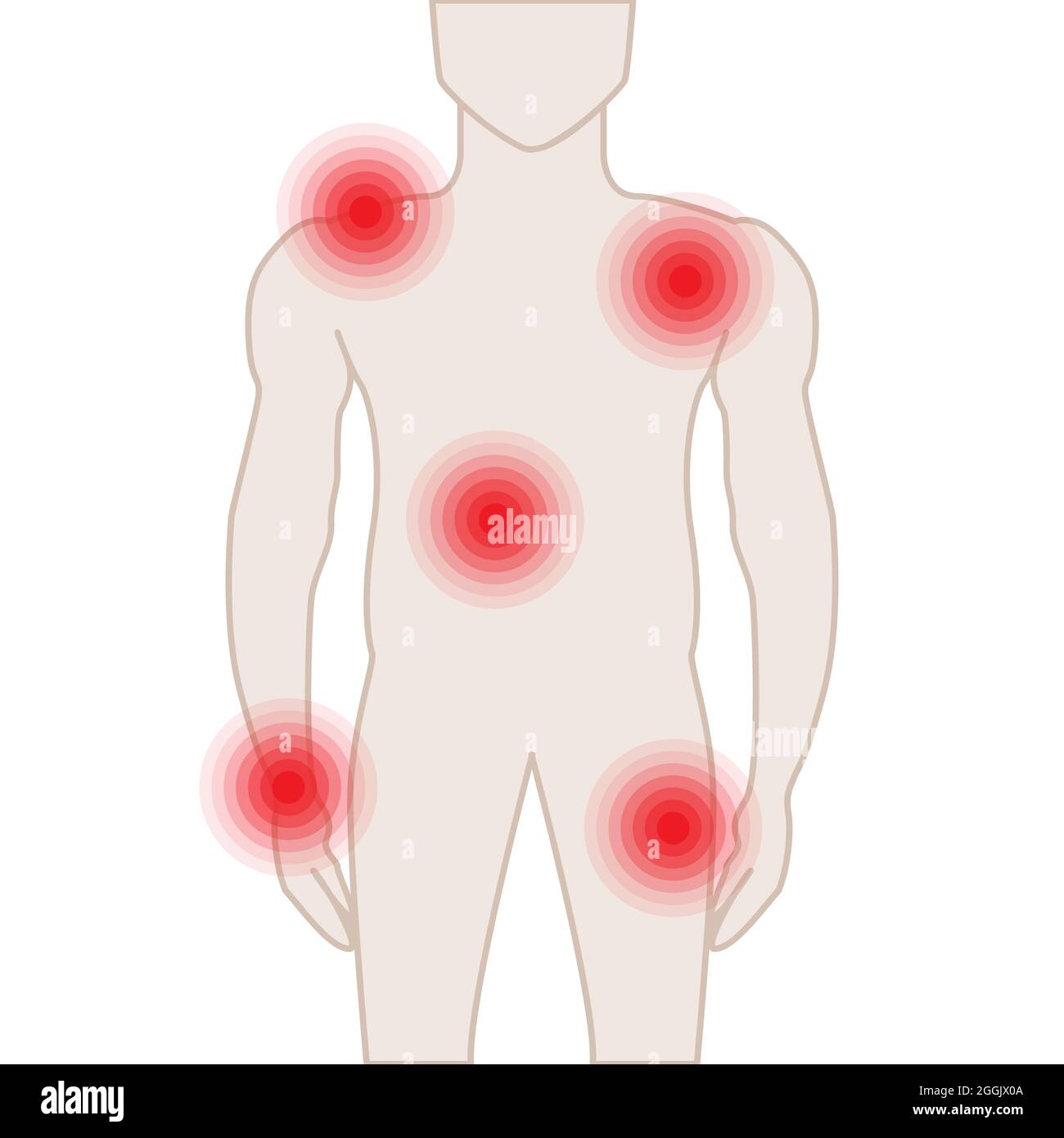 Body Parts Pain Illustration with Aches Stock Vector Image & Art Alamy
