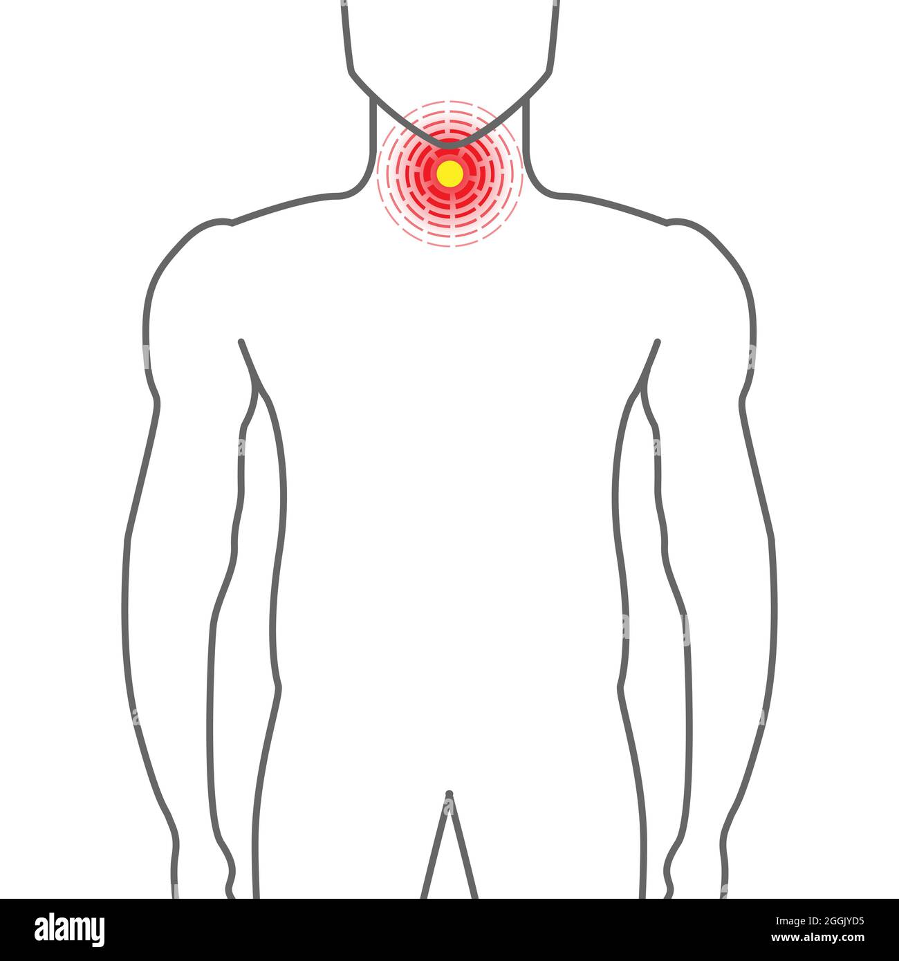 Sore Throat Illustration with Man on White Background Stock Vector