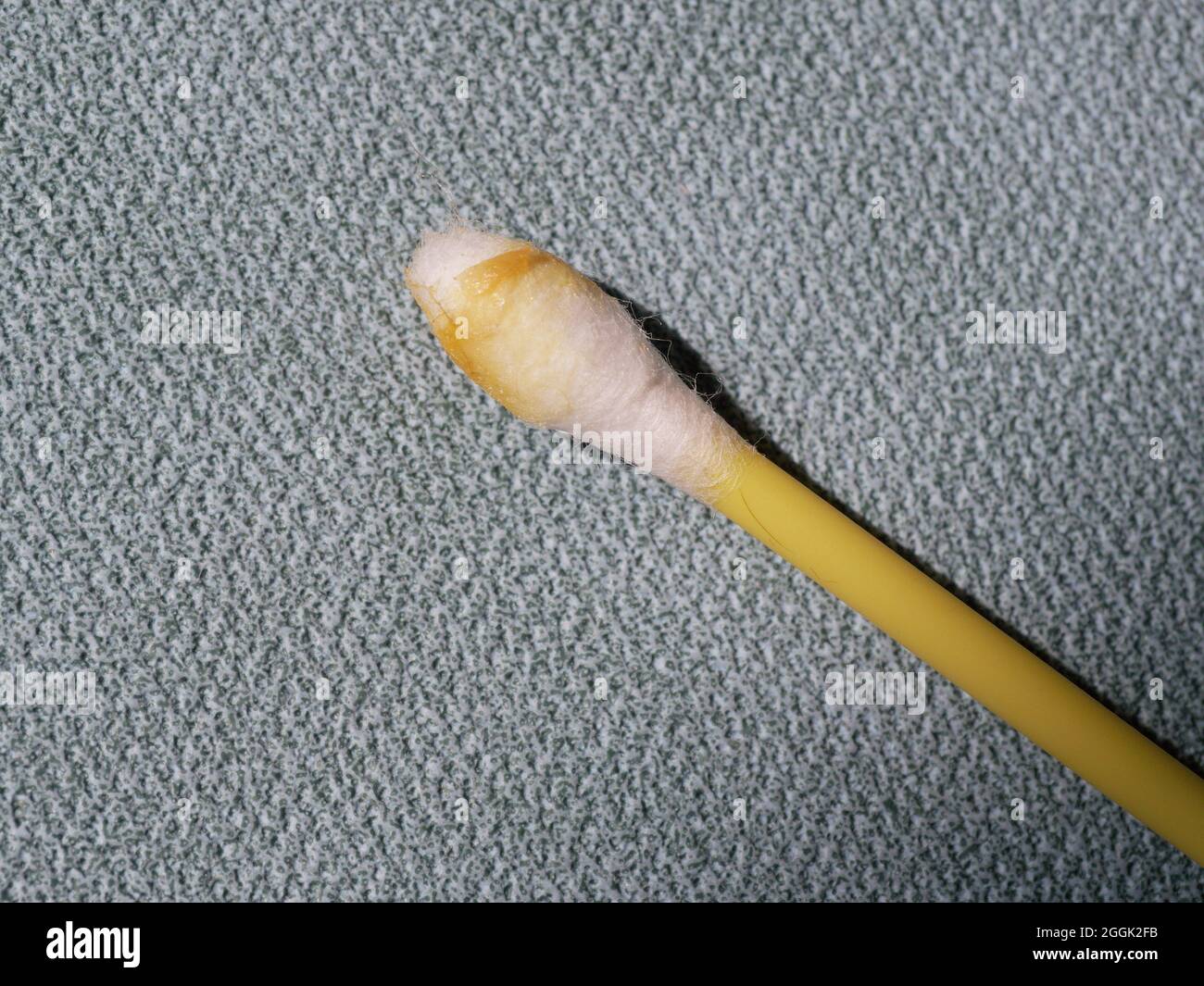 Earwax on a cotton swab, macro photo. Earwax, also known by the medical term cerumen, is a brown, orange, red, yellowish or gray waxy substance secret Stock Photo