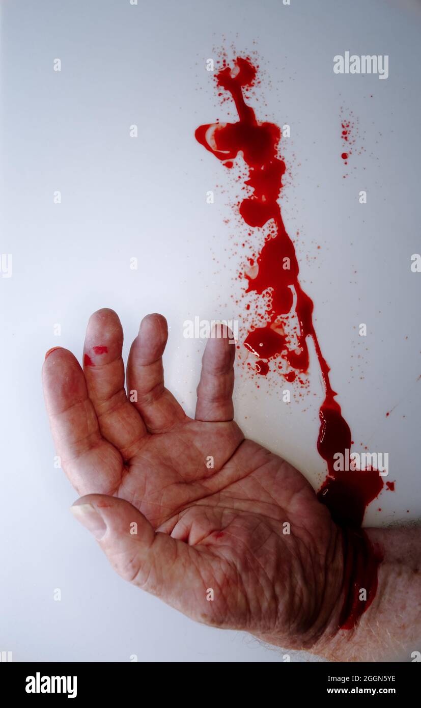 hand with blood pouring from wrist laying on white background Stock Photo -  Alamy