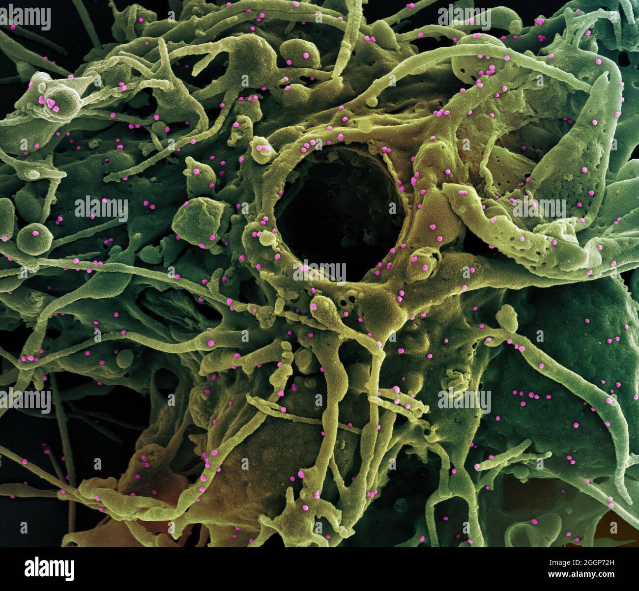 Colorized scanning electron micrograph of a cell (green) infected with UK B. Stock Photo