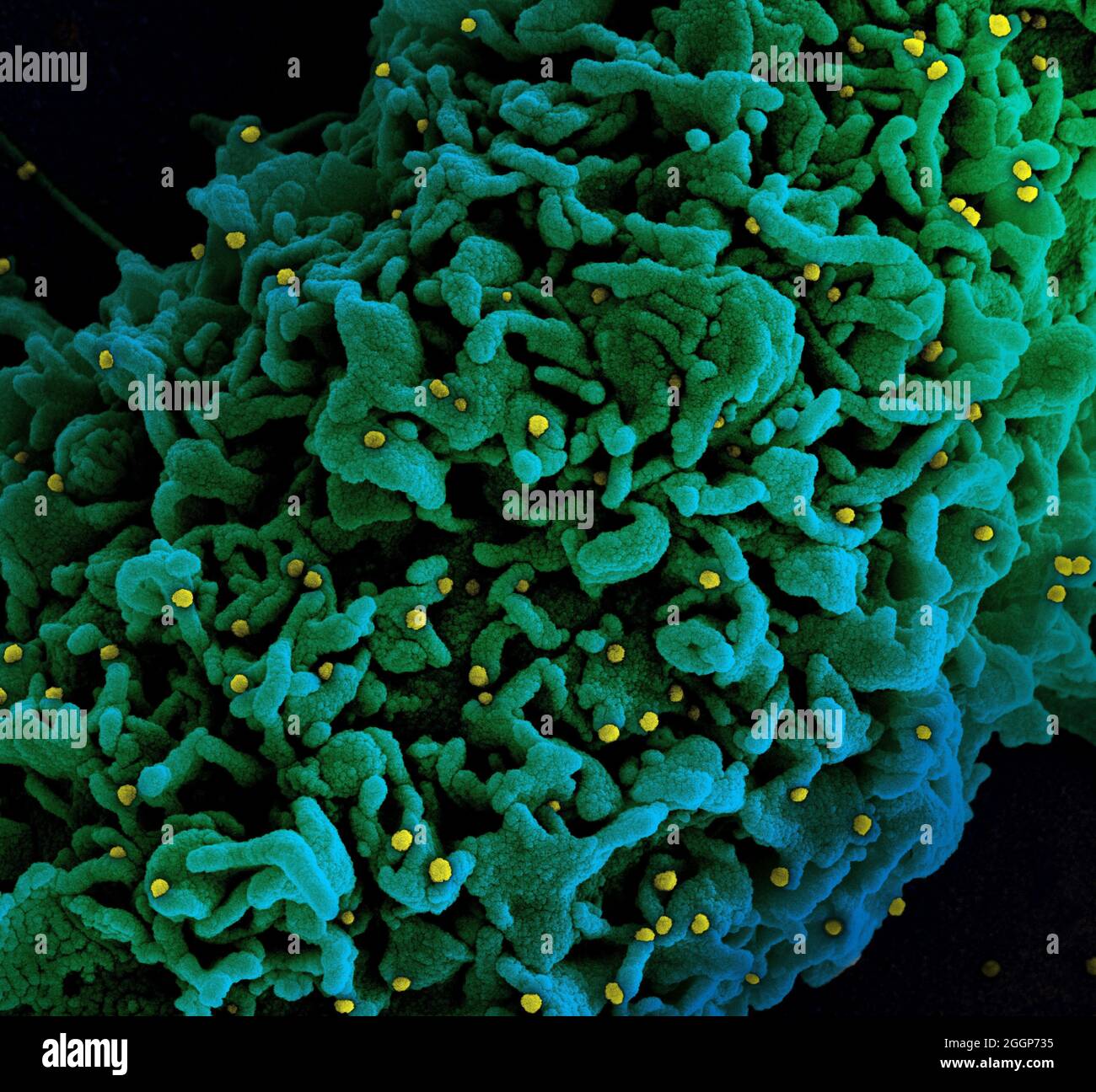 Colorized scanning electron micrograph of a cell (green) infected with UK B. Stock Photo