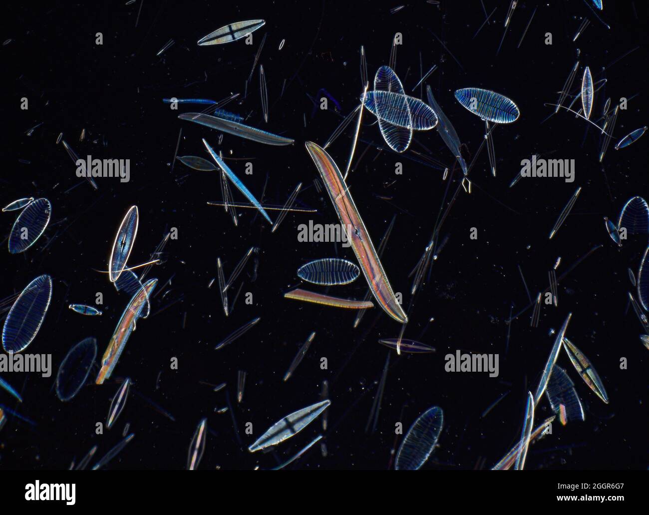 Mixed  diatom species, gyrosigma balticum, surirella gemma Stock Photo