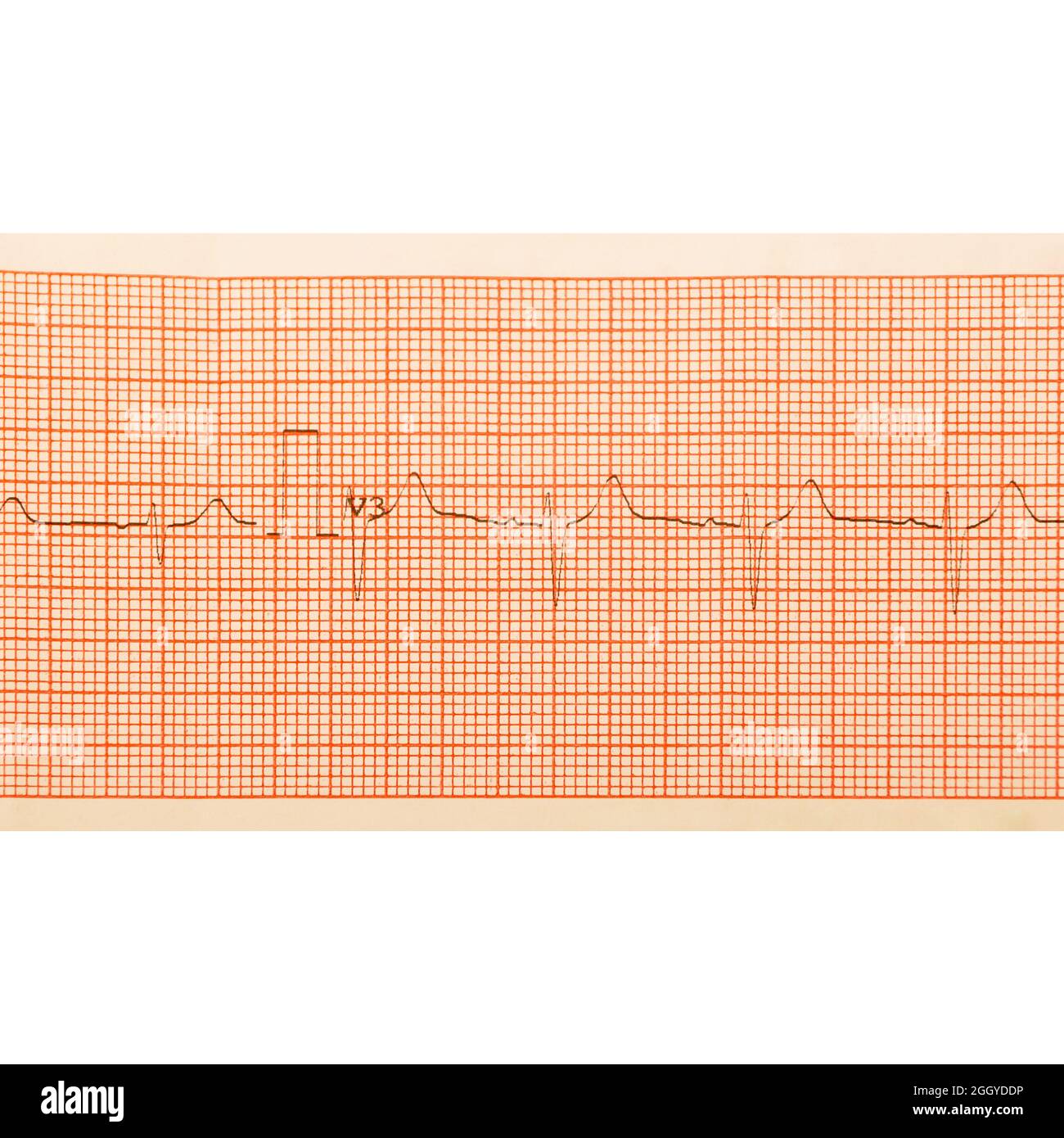 ECG test results on millimeter paper, heart rhythm results, close up of ECG Graph details Stock Photo