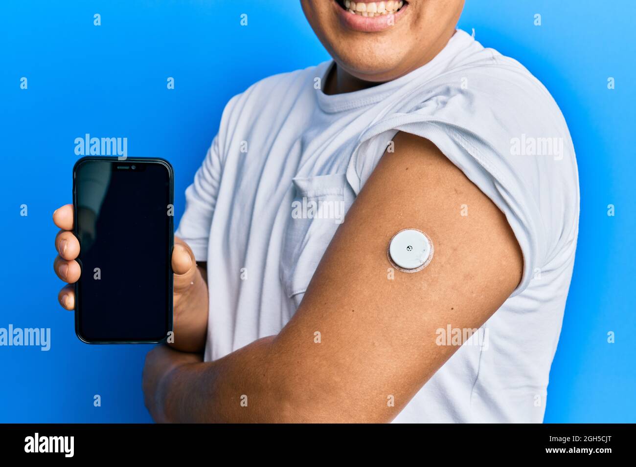 Hispanic man showing diabetes device on arm and holding smartphone with
