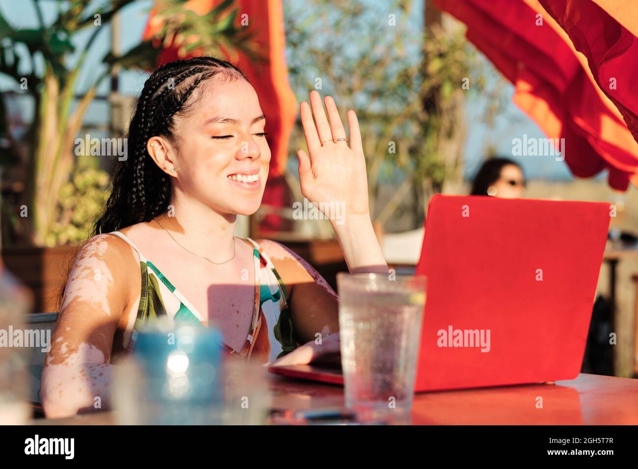 Cheerful Female With Vitiligo Waving Hand While Talking On Video Chat Via Netbook And Sitting At Table In Street Cafe In Summer Stock Photo Alamy Cheerful Female With Vitiligo Waving Hand While Talking On Video Chat Via Netbook And Sitting At Table In Street Cafe In Summer Stock Photo Alamy