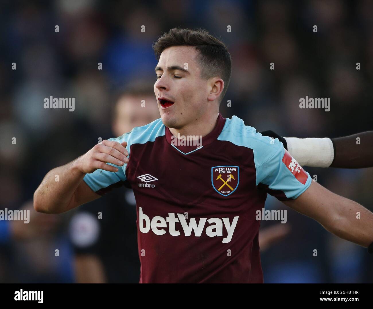 Josh Cullen of West Ham Utd after getting a tooth knocked out during the FA  Cup Third Round match at the New Gay Meadow Stadium, Shrewsbury. Picture  date 7th January 2018. Picture