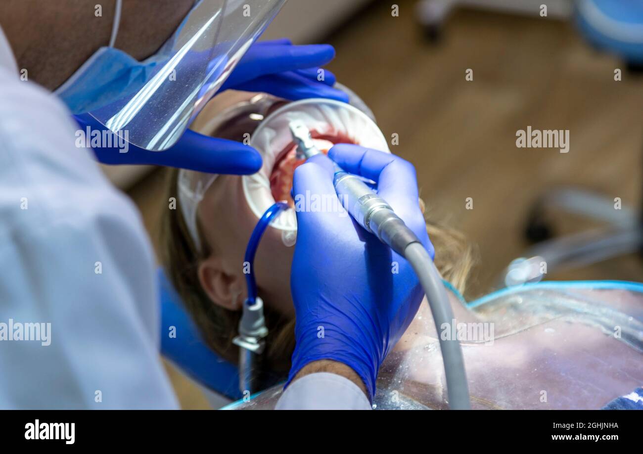 The dentist's hand close, the doctor seals the girl's front teeth. Stock Photo