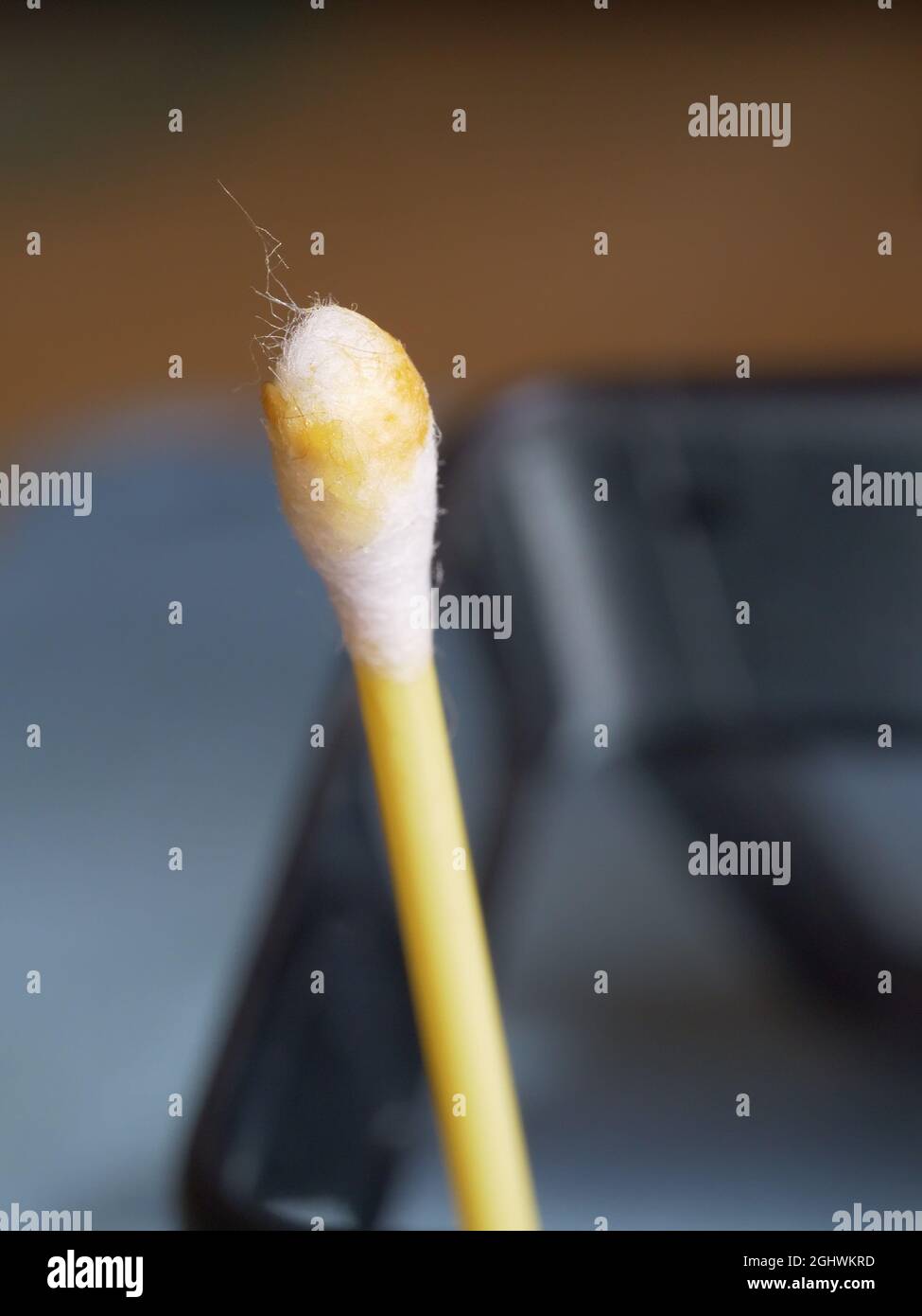 Earwax on a cotton swab, macro photo. Earwax, also known by the medical term cerumen, is a brown, orange, red, yellowish or gray waxy substance secret Stock Photo