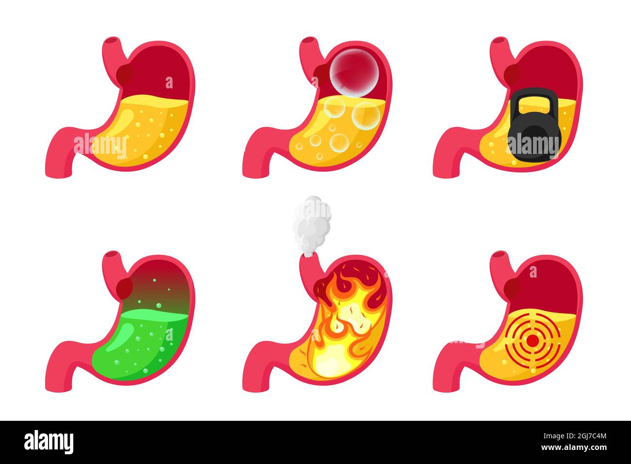 Stomach heartburn, bloating, heaviness, poisoning, ulcer and healthy with gastric acid juice. Digestive system pain problems set. Vector eps cutaway organ illustration Stock Vector