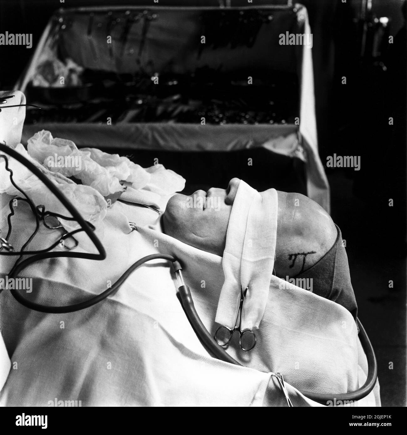 Lobotomy procedure hires stock photography and images Alamy