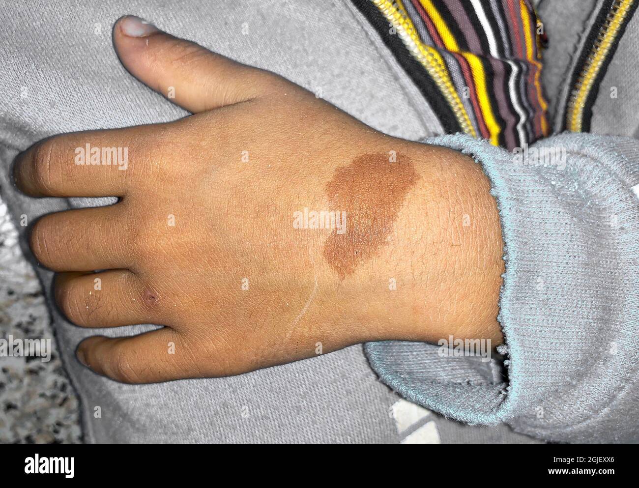 Irregular marks hires stock photography and images Alamy