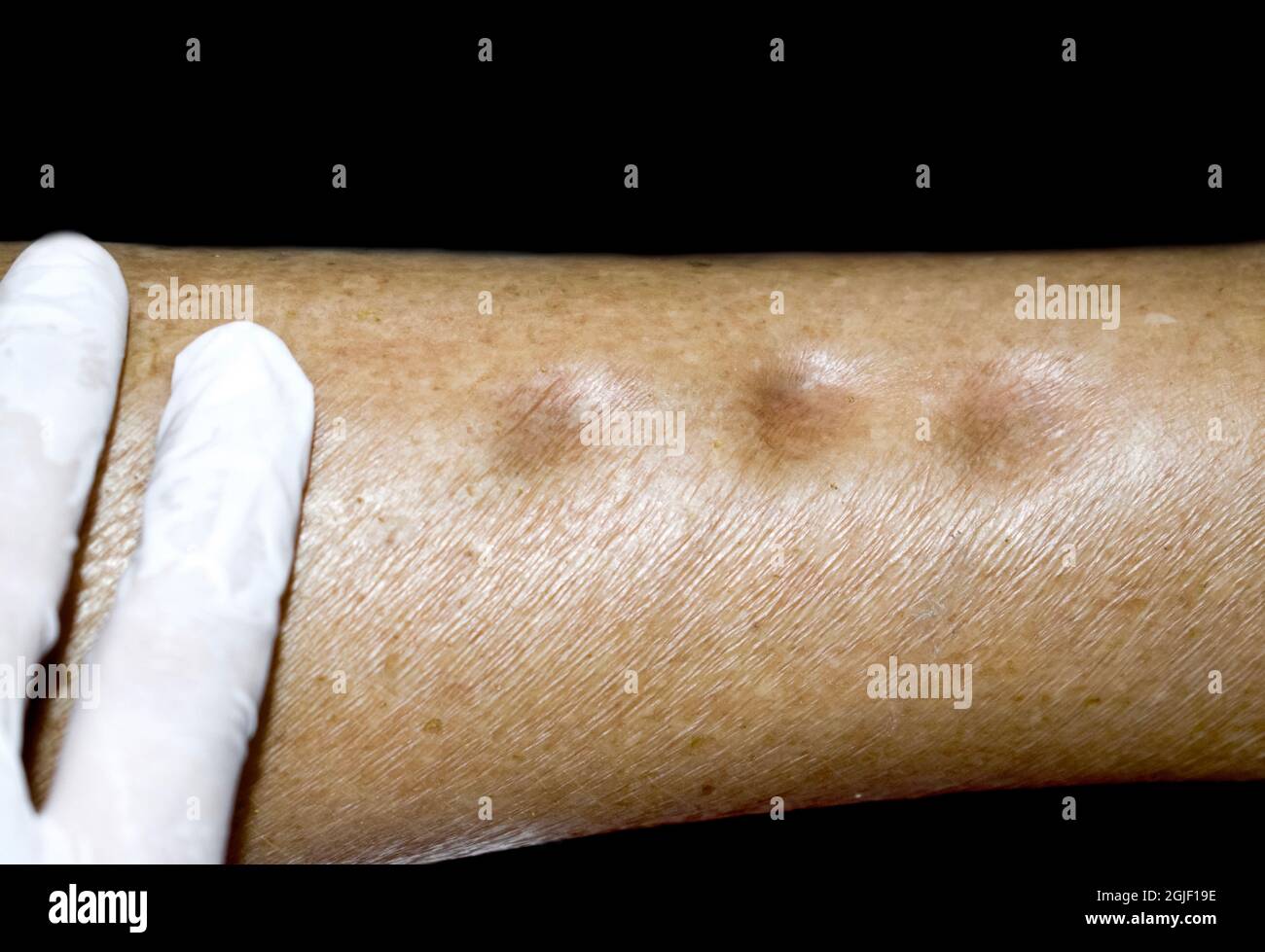 Woman itching leg hires stock photography and images Alamy