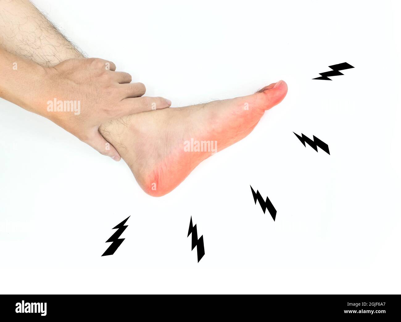 Tingling and burning sensation in foot of Asian young man with diabetes