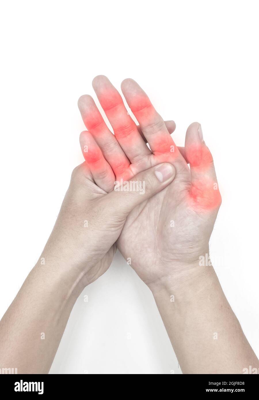 Inflammation at finger joints of Asian young man. Concept of hand joints pain. Isolated on white. Stock Photo
