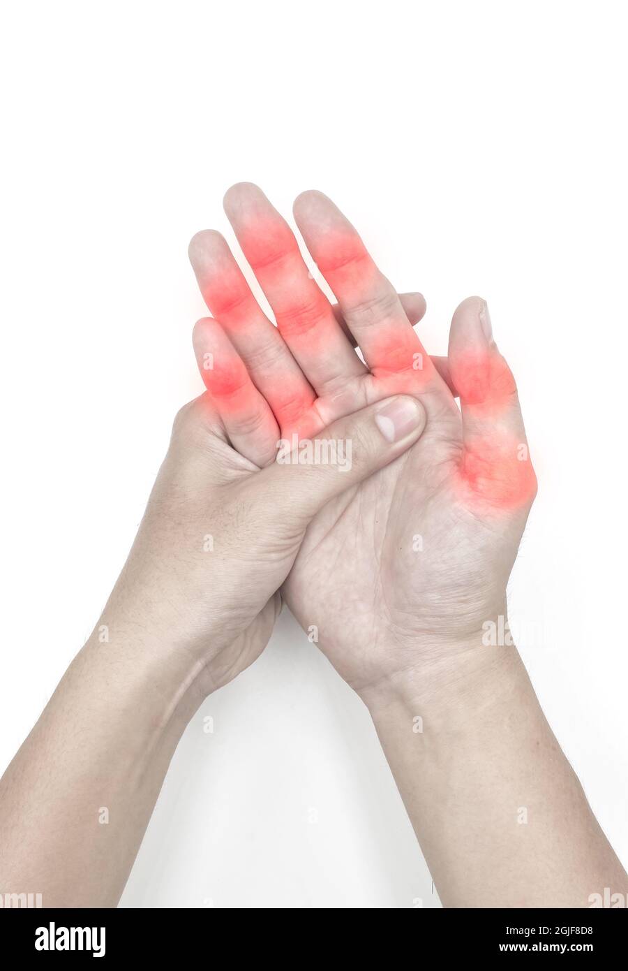Inflammation at finger joints of Asian young man. Concept of hand