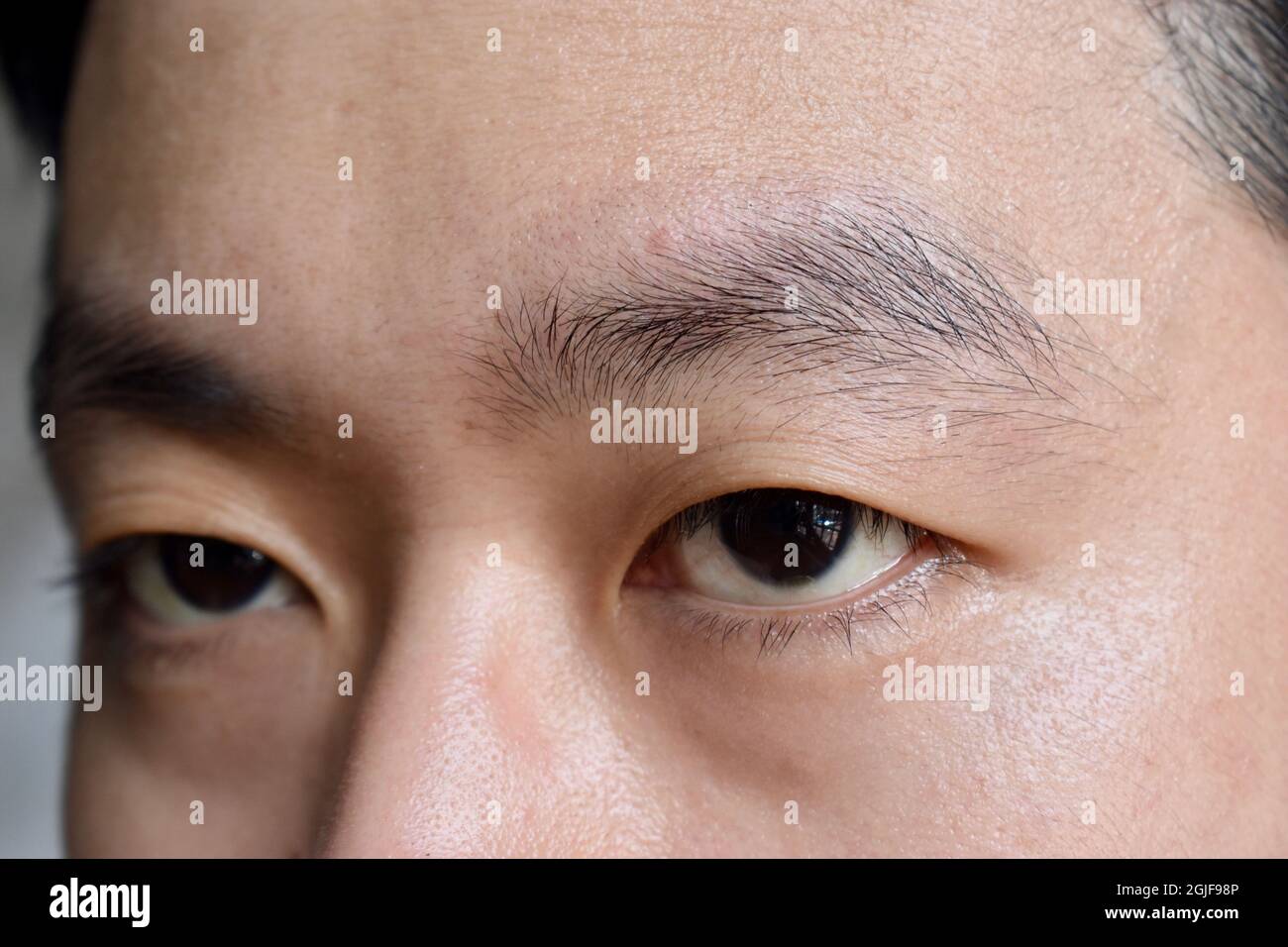 Aging skin folds or skin creases or wrinkles at face especially around eye of Southeast Asian, Chinese man. Closeup view. Stock Photo