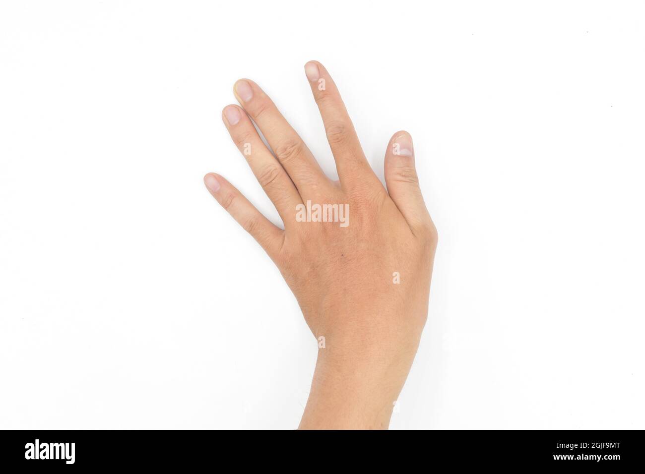 Rigid finger muscles in Asian young man. Unilateral hand muscle spasm