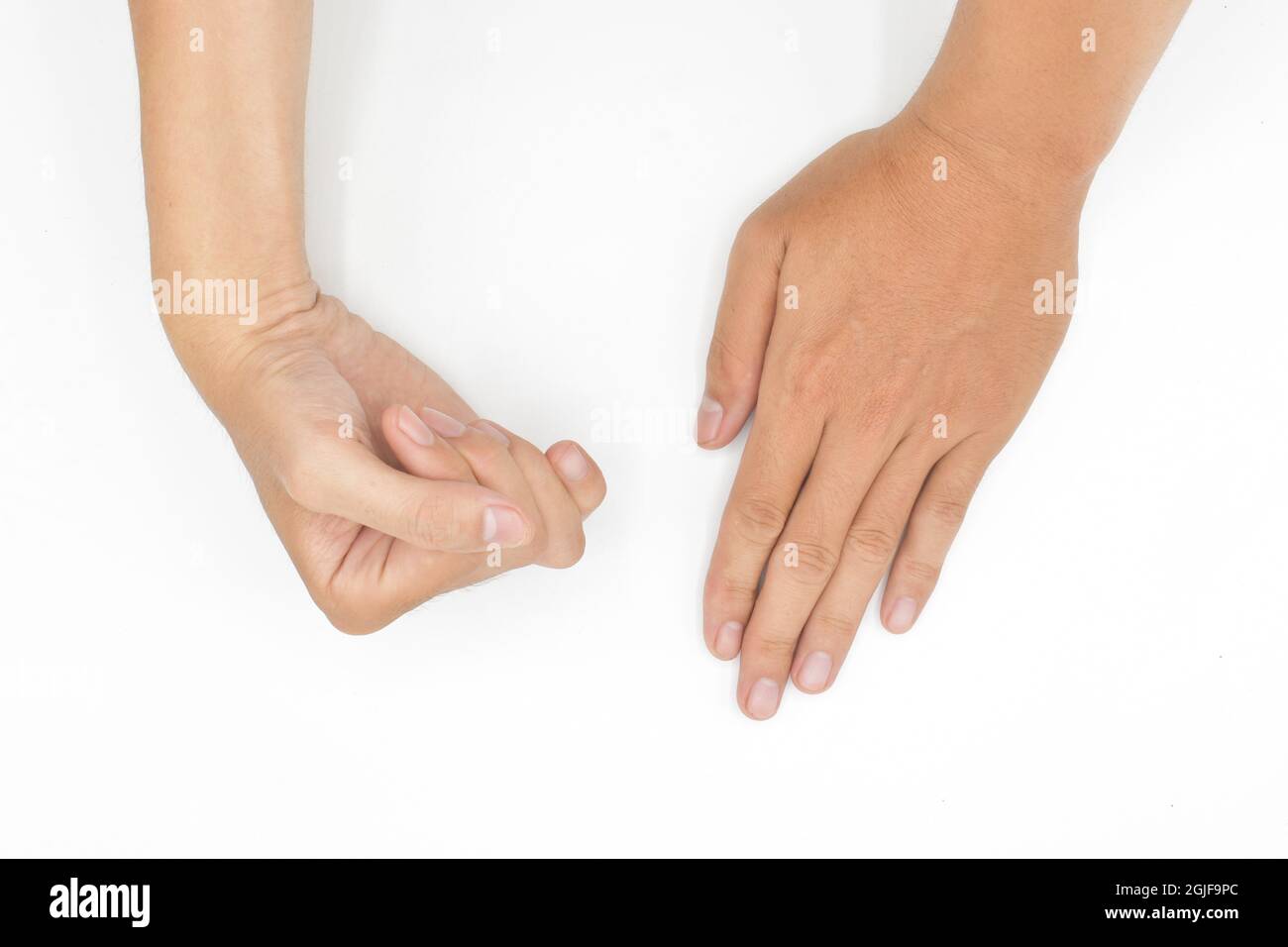 Hand muscle spasm in Asian young man. Unilateral hand deformity. Abnormal fingers flexion. Isolated on white background. Stock Photo