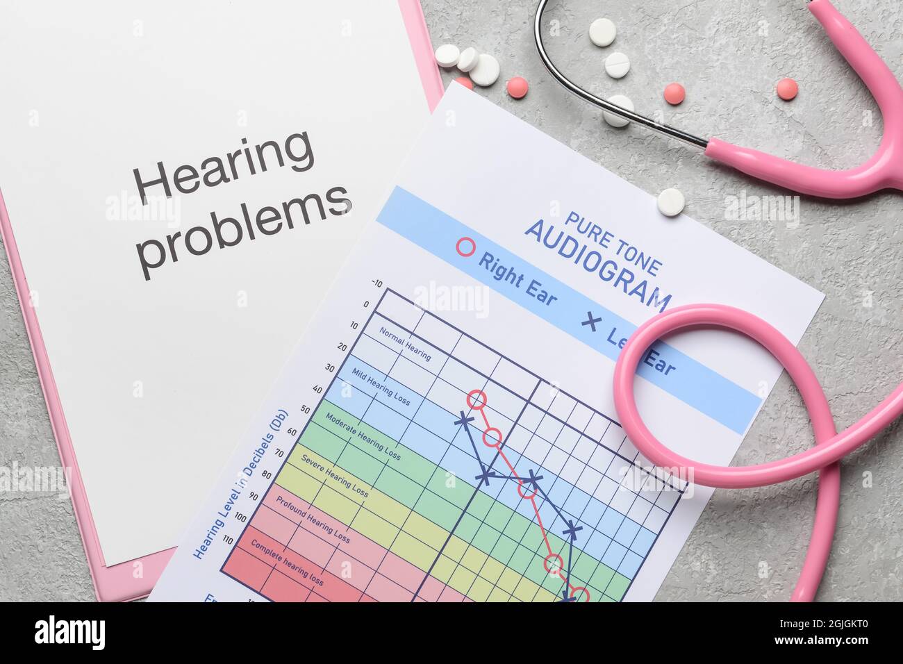 Clipboard with text HEARING PROBLEMS, stethoscope and audiogram on light background Stock Photo