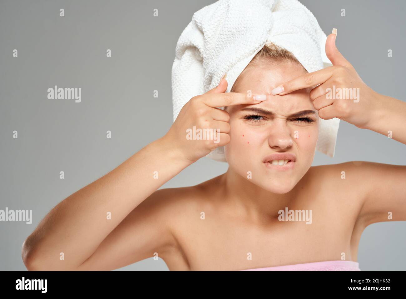 woman with a towel on her head acne on her face dermatology skin care ...