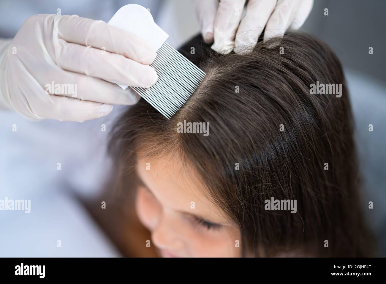 Head lice kid hires stock photography and images Alamy