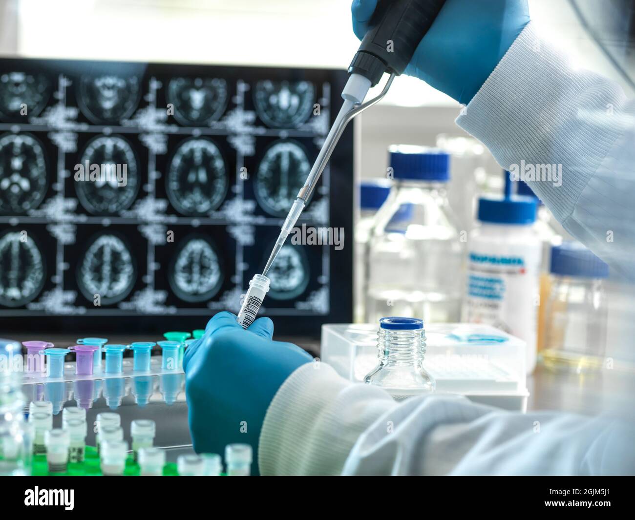 Alzheimer’s brain mri hi-res stock photography and images - Alamy