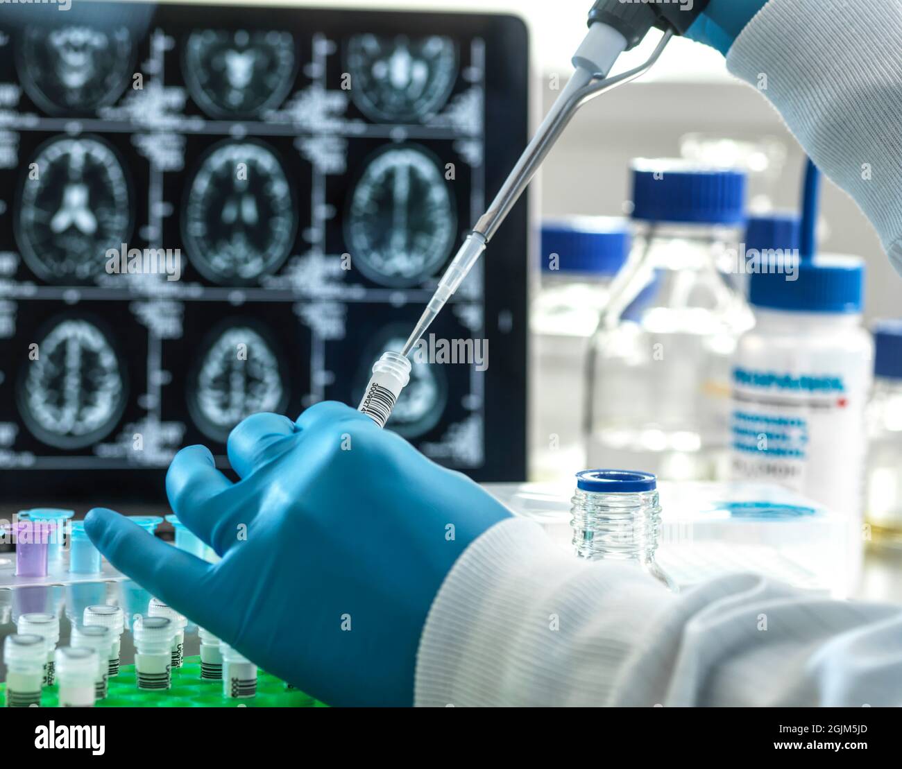 Alzheimers and dementia research Stock Photo