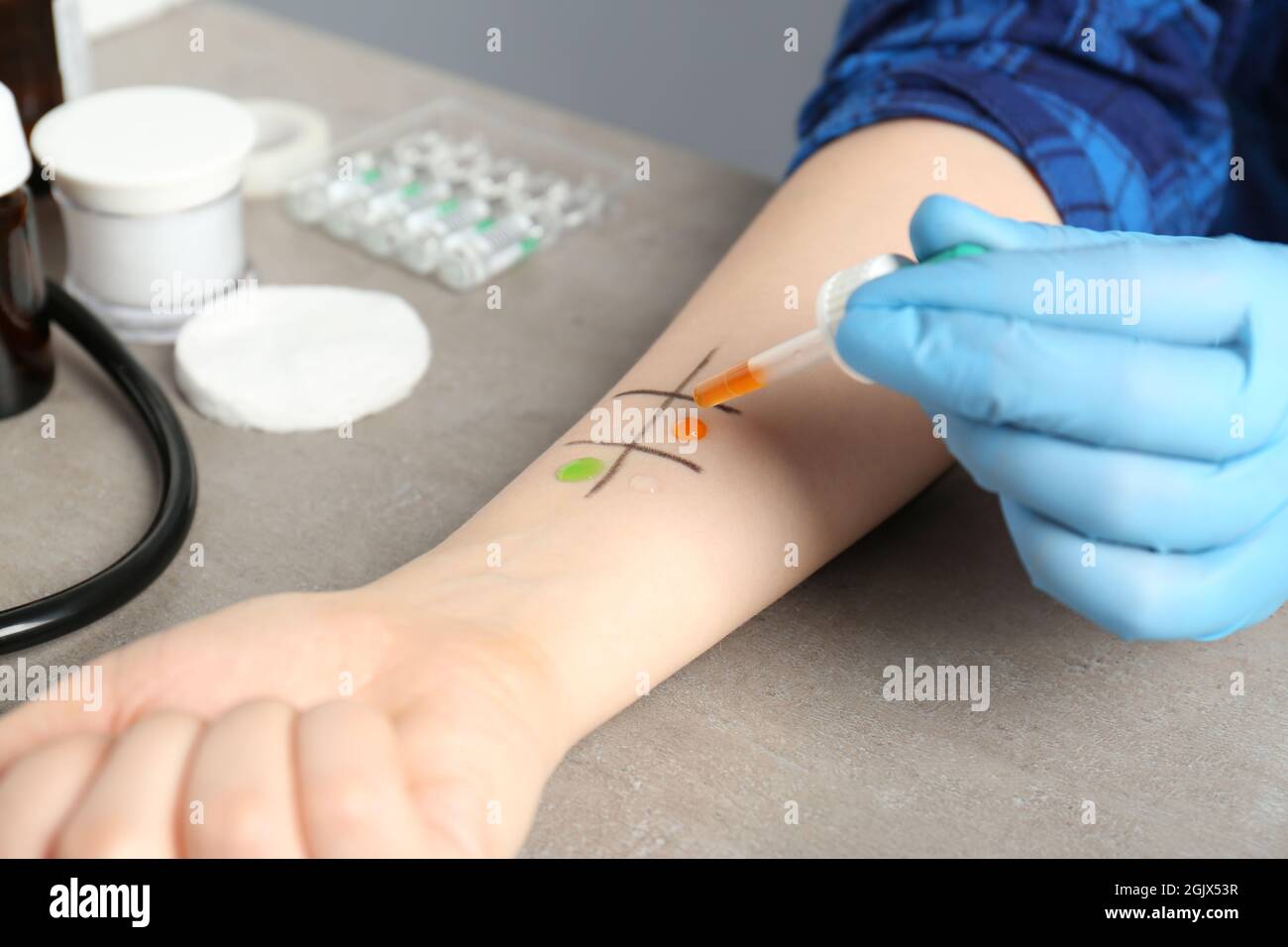 Patient making allergy test in laboratory Stock Photo Alamy