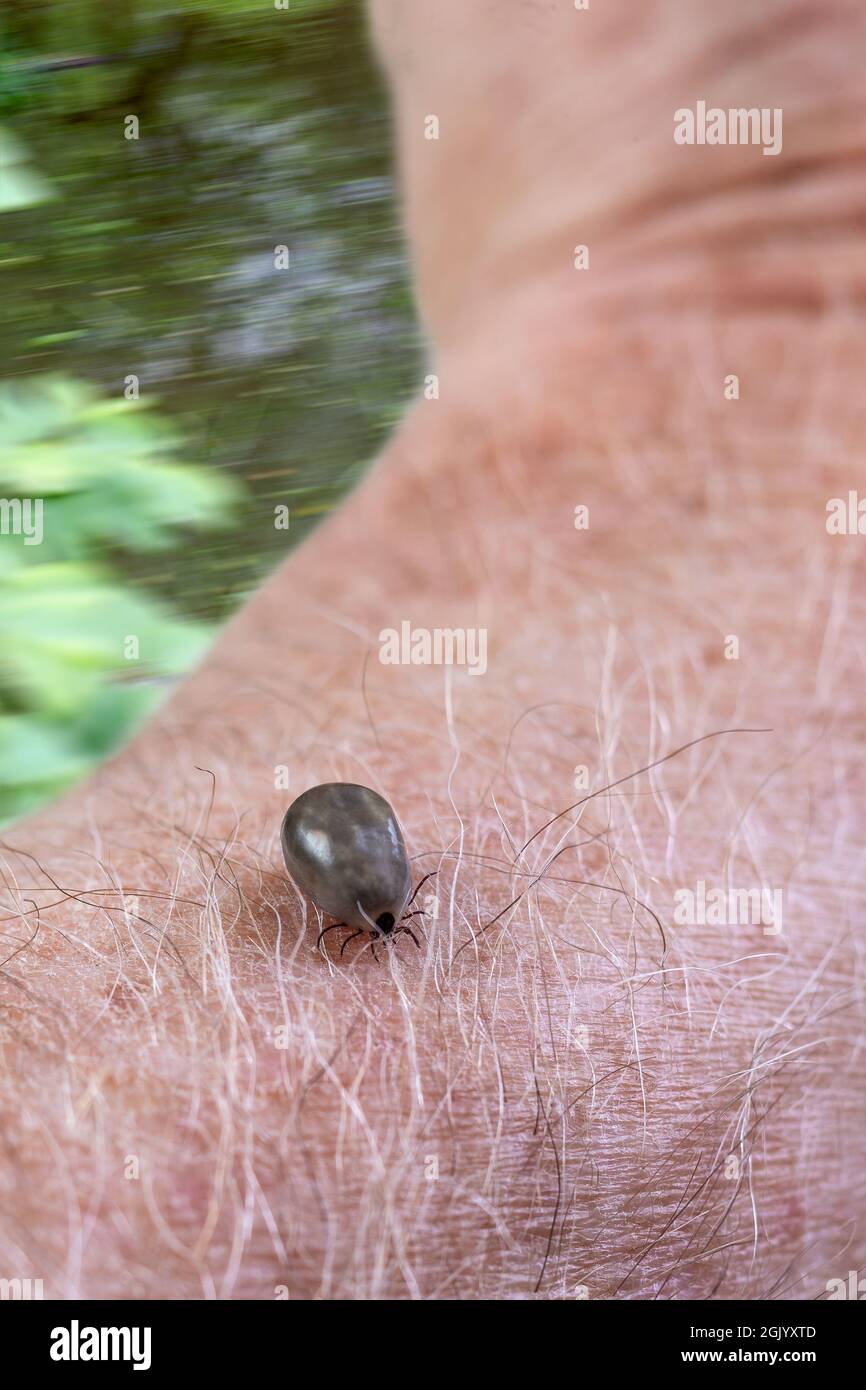 Close-up of a tick crawling on a human skin. Stock Photo