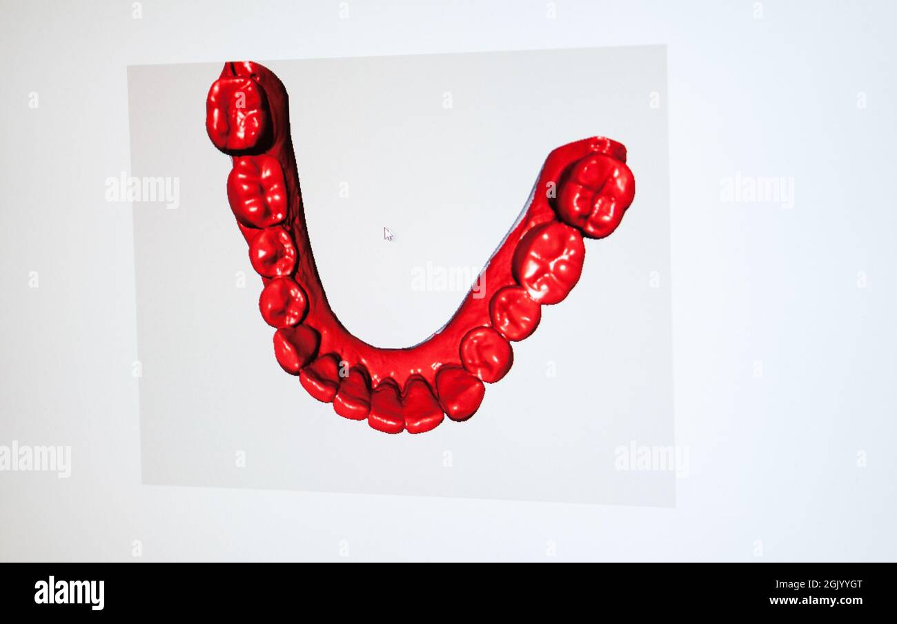 Report in a dental prosthesis laboratory that uses a Computer Aided ...