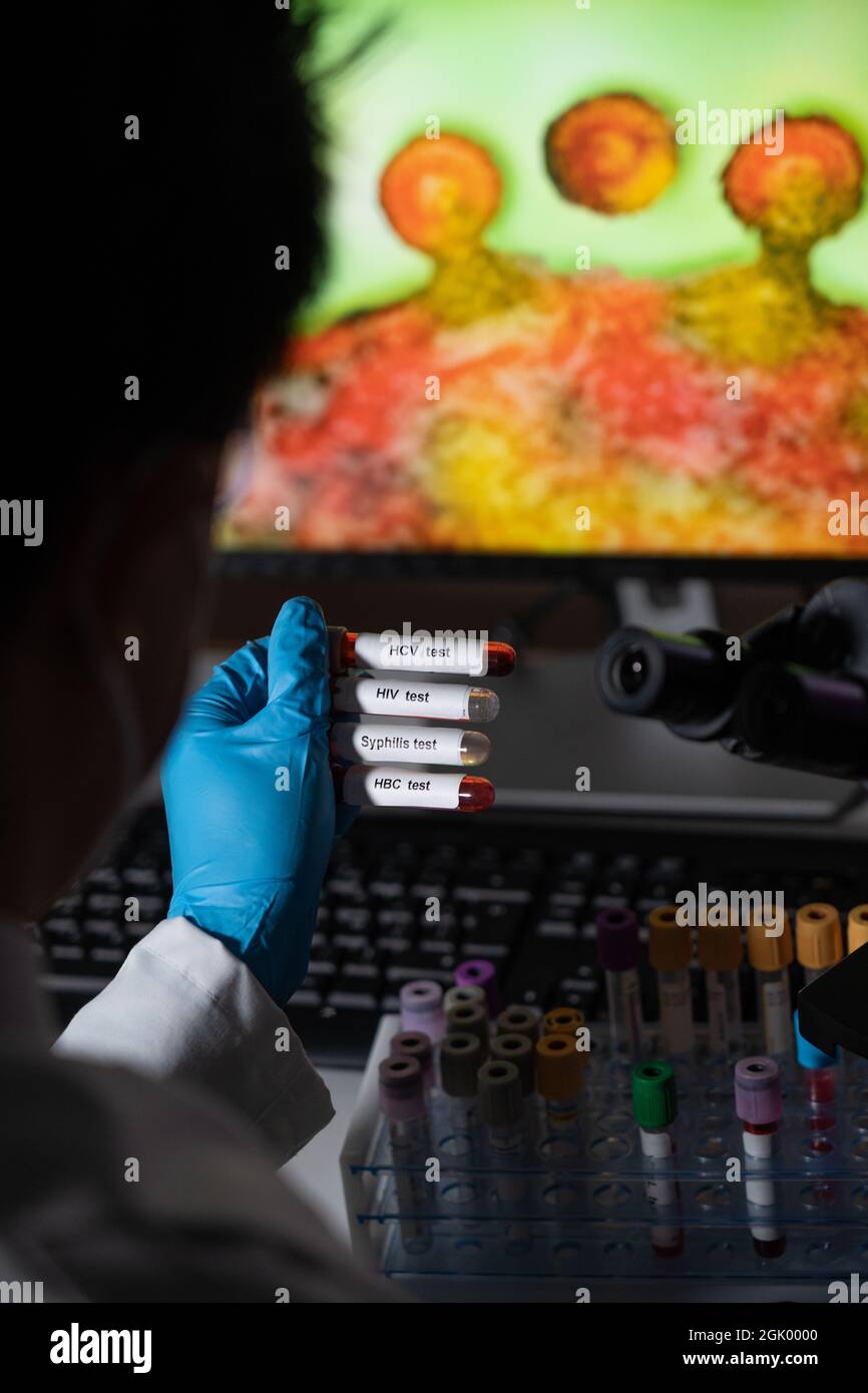 Blood tests to detect sexually transmitted diseases or STDs hepatitis