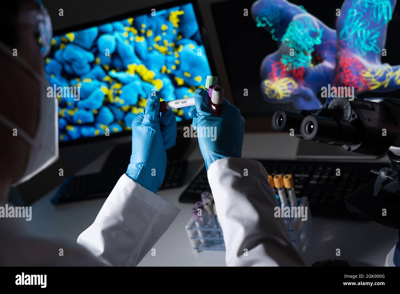 Blood tests to detect sexually transmitted diseases or STDs hepatitis B and C, syphilis, HIV