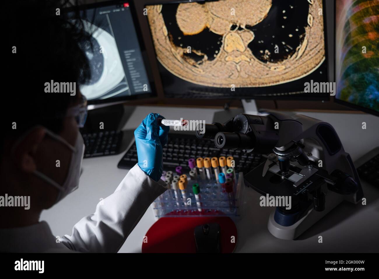 Blood tests for Covid19 screening and Xray or CT images of infected