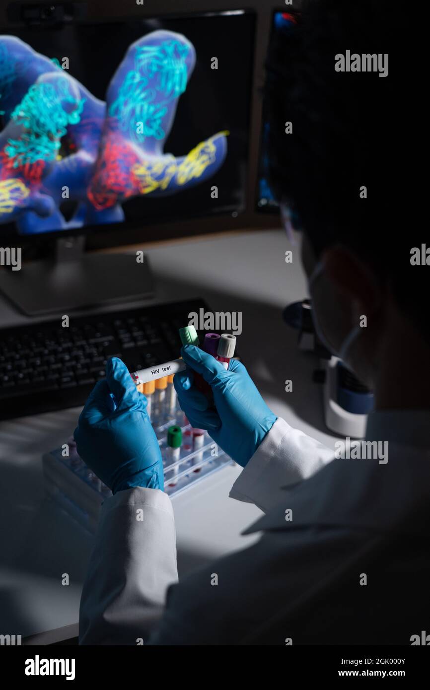 Blood tests to detect sexually transmitted diseases or STDs hepatitis B and C, syphilis, HIV